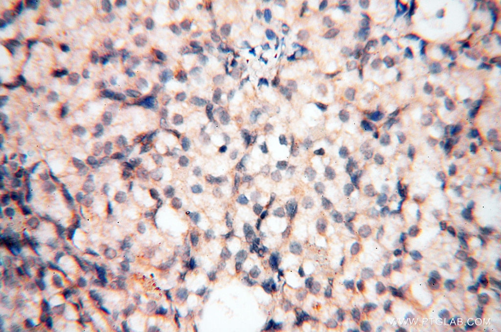 IHC staining of human ovary using 18422-1-AP