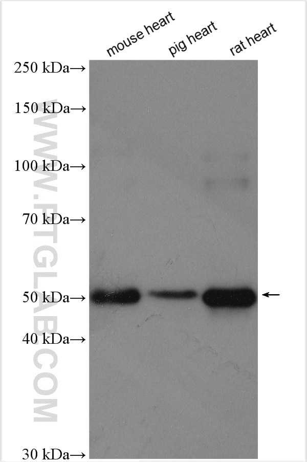 Western Blot (WB) analysis of various lysates using Calsequestrin 2 Polyclonal antibody (18422-1-AP)