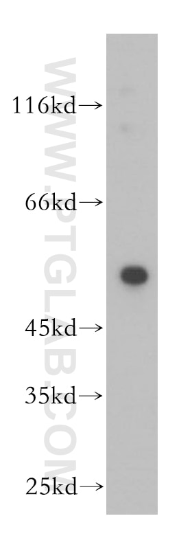 Western Blot (WB) analysis of human heart tissue using Calsequestrin 2 Polyclonal antibody (18422-1-AP)