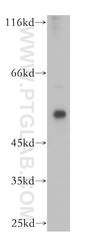 Western Blot (WB) analysis of human skeletal muscle tissue using Calsequestrin 2 Polyclonal antibody (18422-1-AP)