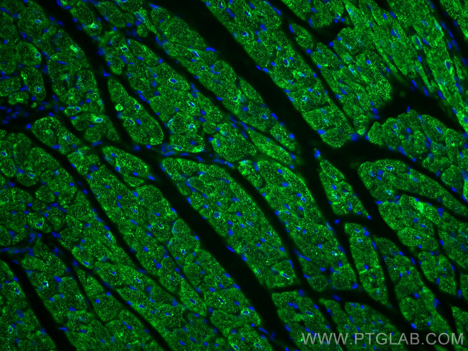 Immunofluorescence (IF) / fluorescent staining of mouse heart tissue using Calsequestrin 2 Monoclonal antibody (66419-1-Ig)