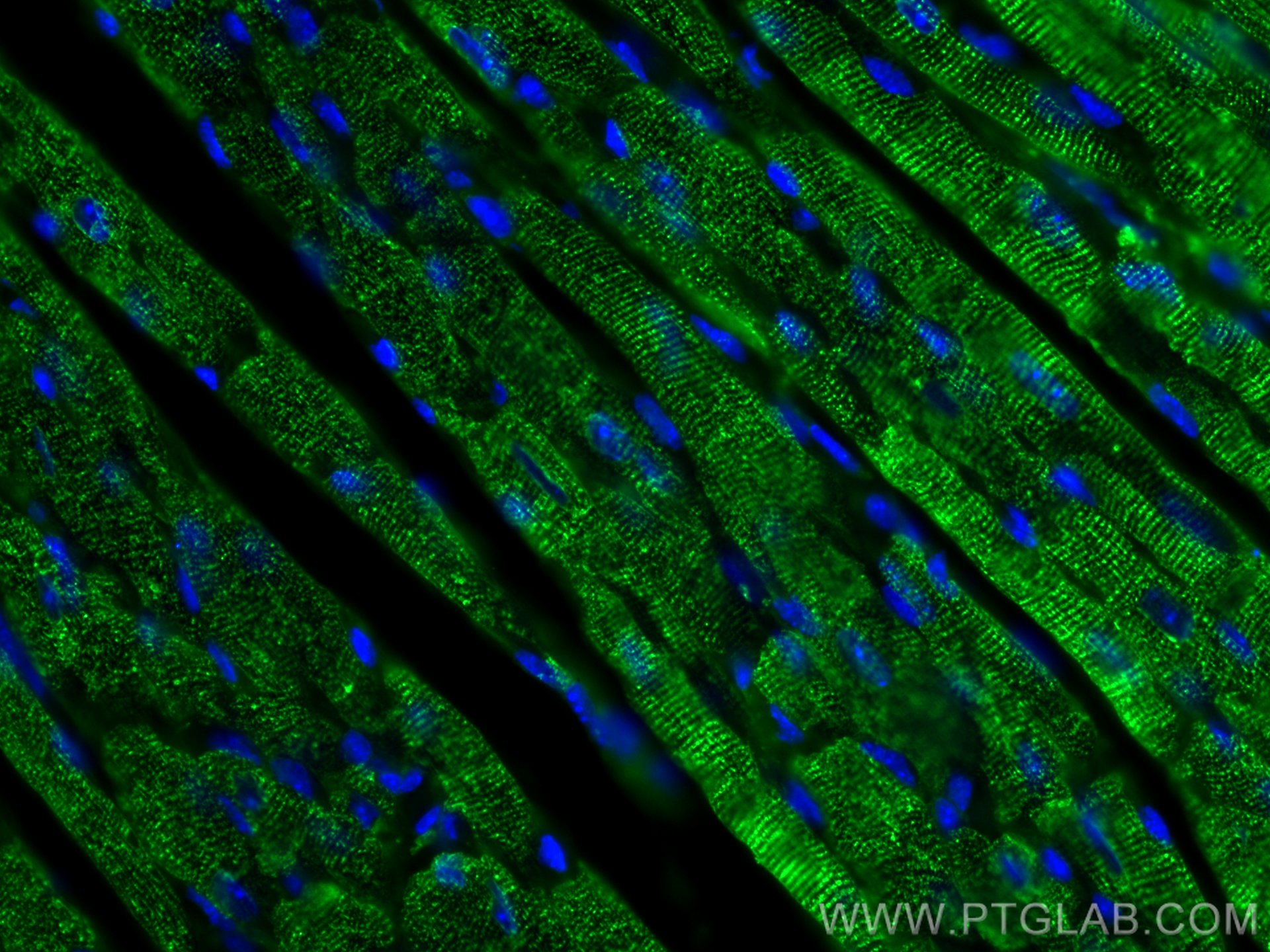 Immunofluorescence (IF) / fluorescent staining of mouse heart tissue using Calsequestrin 2 Monoclonal antibody (66419-1-Ig)