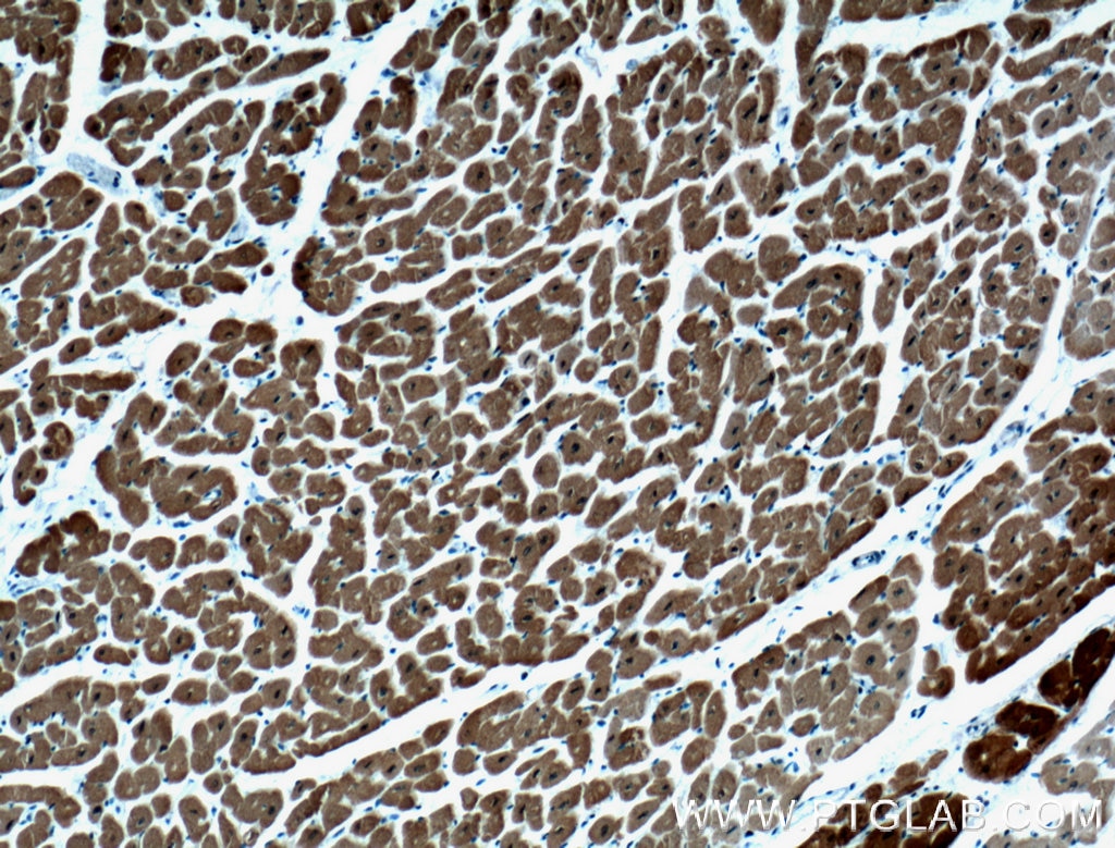 Immunohistochemistry (IHC) staining of human heart tissue using Calsequestrin 2 Monoclonal antibody (66419-1-Ig)