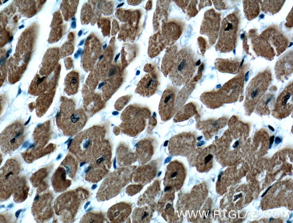 Immunohistochemistry (IHC) staining of human heart tissue using Calsequestrin 2 Monoclonal antibody (66419-1-Ig)