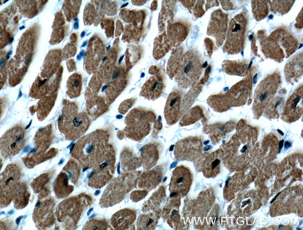 IHC staining of human heart using 66419-1-Ig