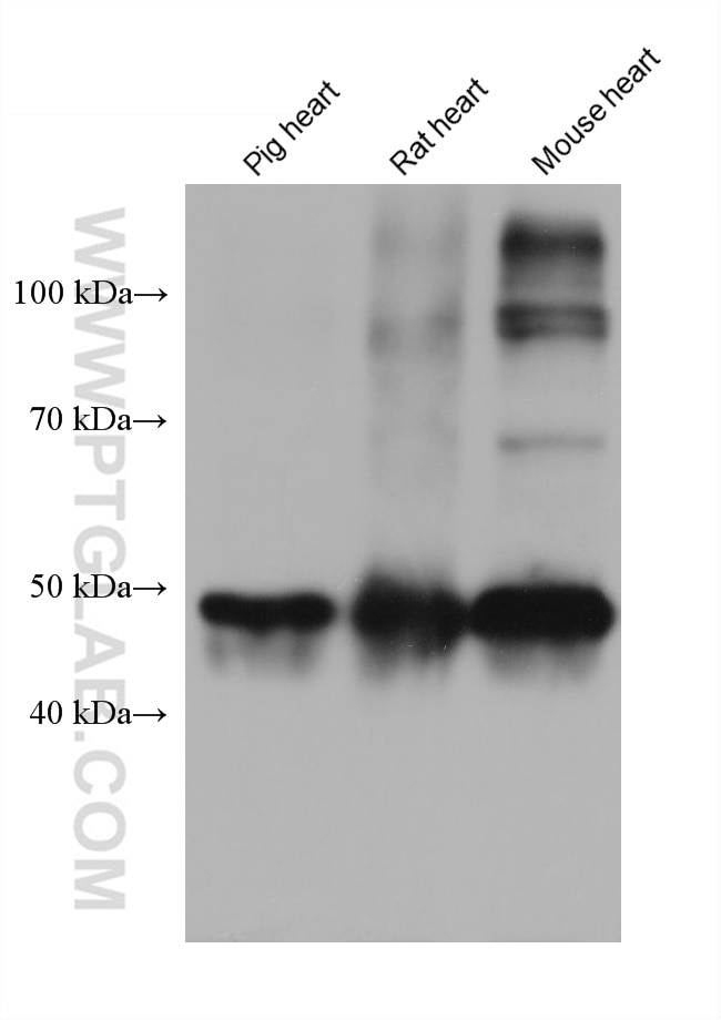 Western Blot (WB) analysis of various lysates using Calsequestrin 2 Monoclonal antibody (66419-1-Ig)