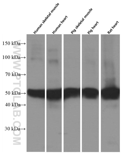 Western Blot (WB) analysis of various lysates using Calsequestrin 2 Monoclonal antibody (66419-1-Ig)