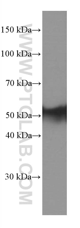 Western Blot (WB) analysis of rat skeletal muscle tissue using Calsequestrin 2 Monoclonal antibody (66419-1-Ig)