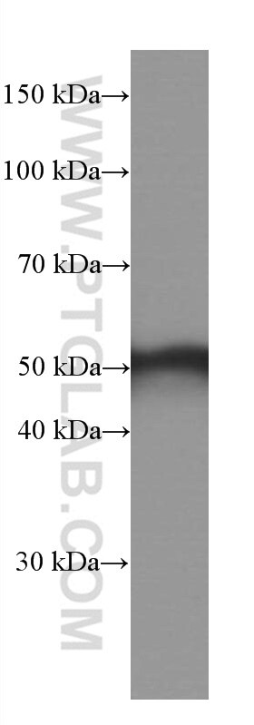 Western Blot (WB) analysis of mouse skeletal muscle tissue using Calsequestrin 2 Monoclonal antibody (66419-1-Ig)