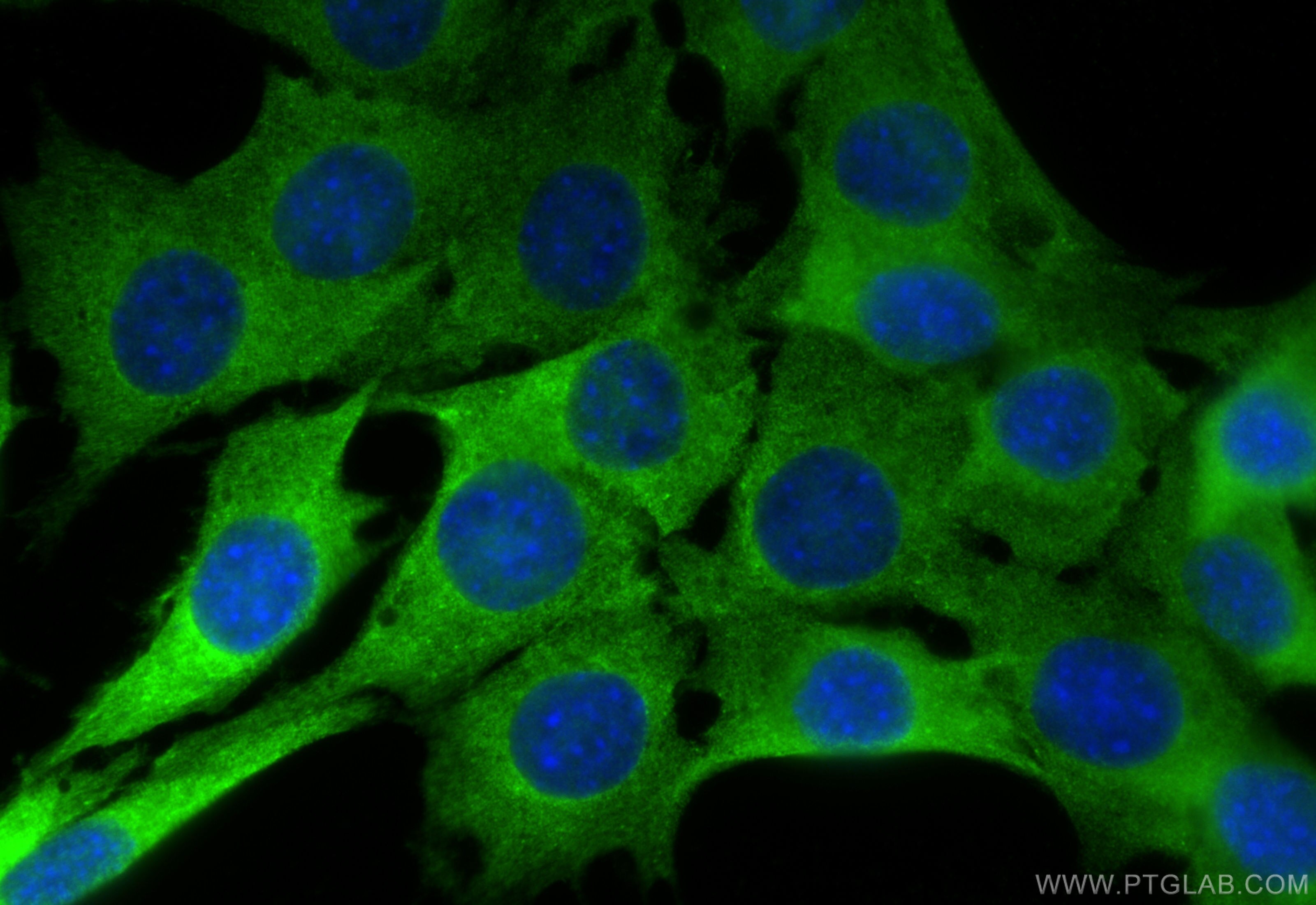 Immunofluorescence (IF) / fluorescent staining of C2C12 cells using CASQ2 Recombinant antibody (84056-6-RR)