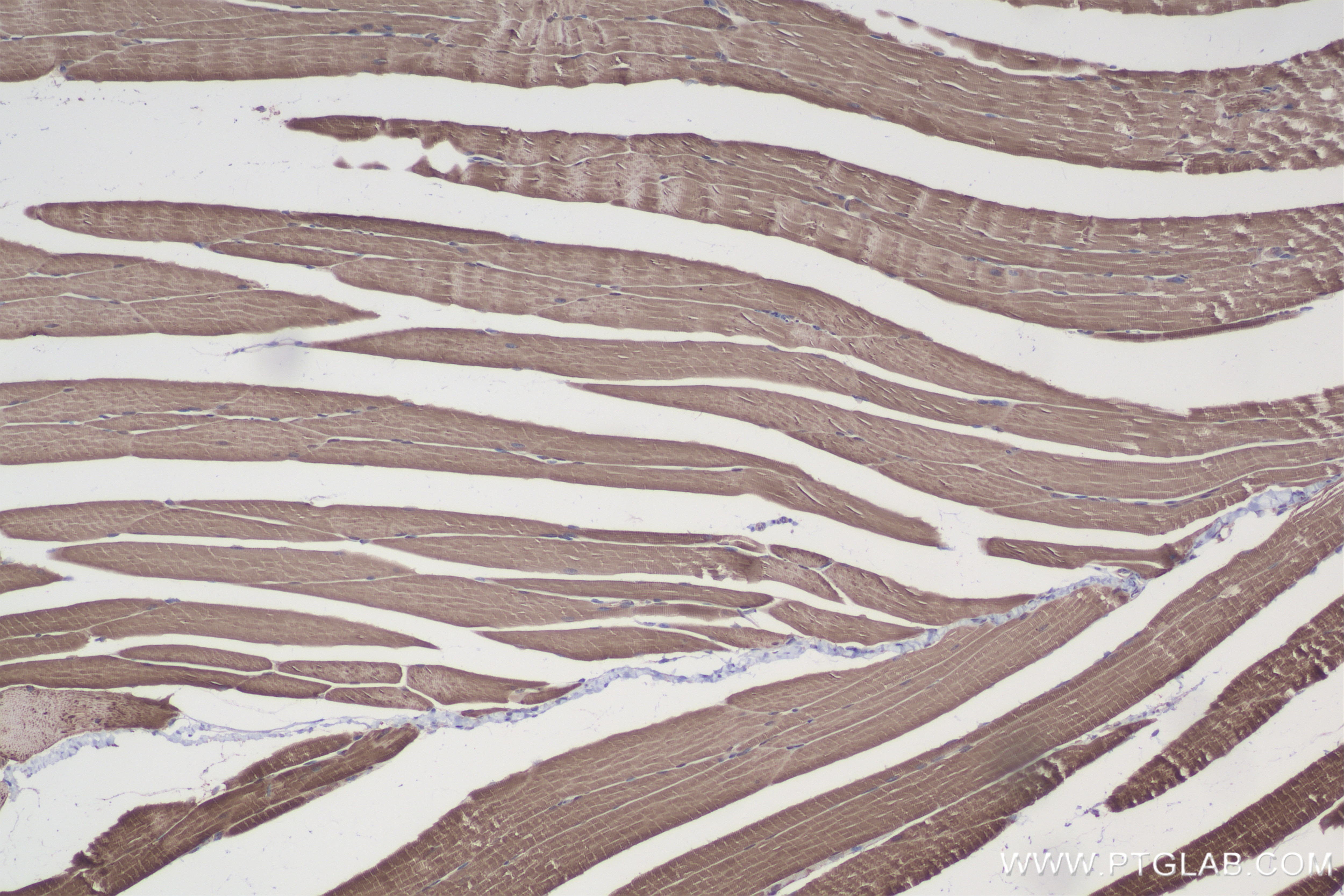 Immunohistochemistry (IHC) staining of mouse skeletal muscle tissue using CASQ2 Recombinant antibody (84056-6-RR)