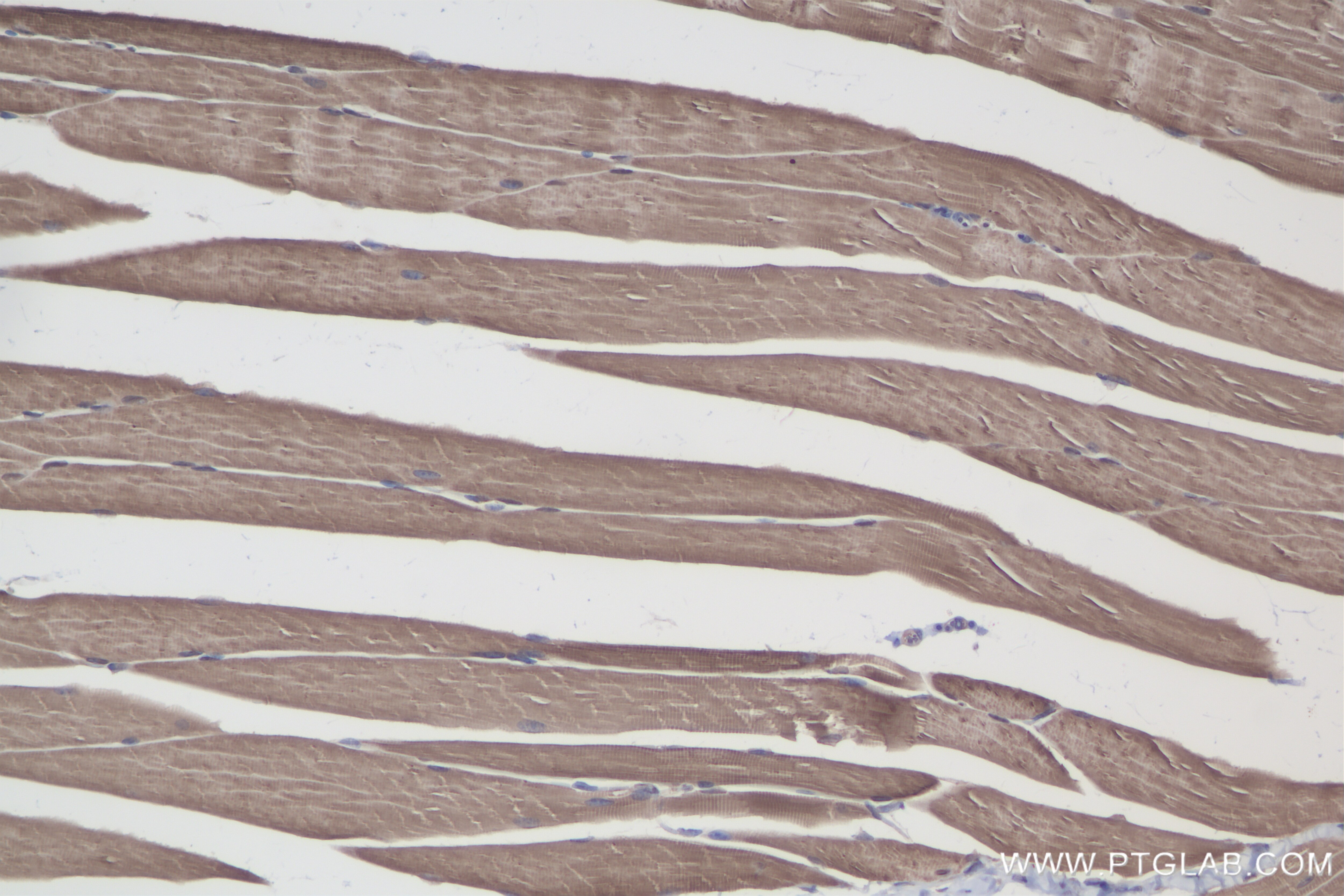 Immunohistochemistry (IHC) staining of mouse skeletal muscle tissue using CASQ2 Recombinant antibody (84056-6-RR)
