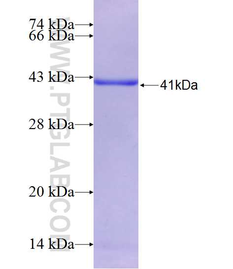 CASQ2 fusion protein Ag26412 SDS-PAGE