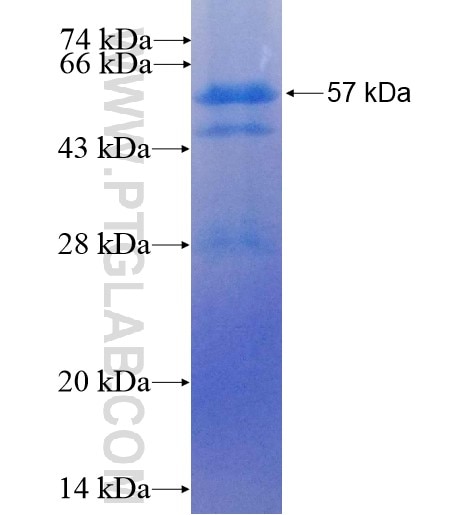 CASQ2 fusion protein Ag13246 SDS-PAGE