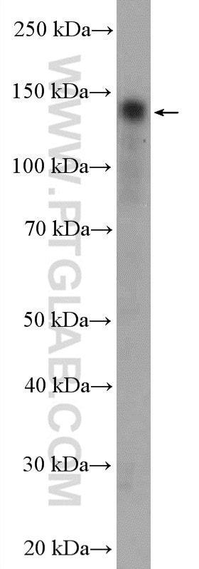 Western Blot (WB) analysis of Jurkat cells using Calcium Sensing Receptor Polyclonal antibody (19125-1-AP)