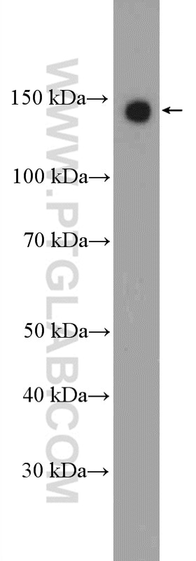 Western Blot (WB) analysis of COLO 320 cells using Calcium Sensing Receptor Polyclonal antibody (19125-1-AP)