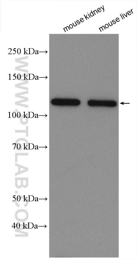 Western Blot (WB) analysis of various lysates using Calcium Sensing Receptor Polyclonal antibody (19125-1-AP)