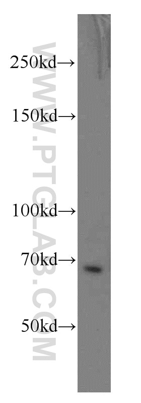 Calcium Sensing Receptor