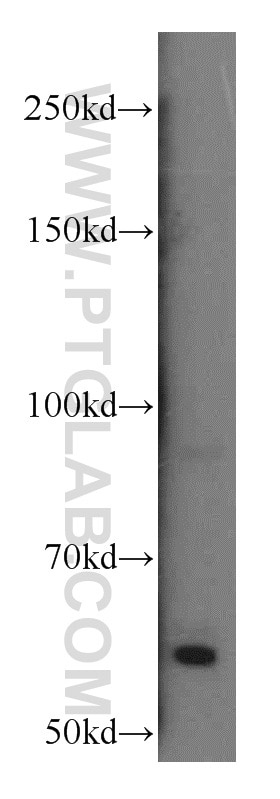 Western Blot (WB) analysis of HL-60 cells using Calcium Sensing Receptor Polyclonal antibody (19125-1-AP)