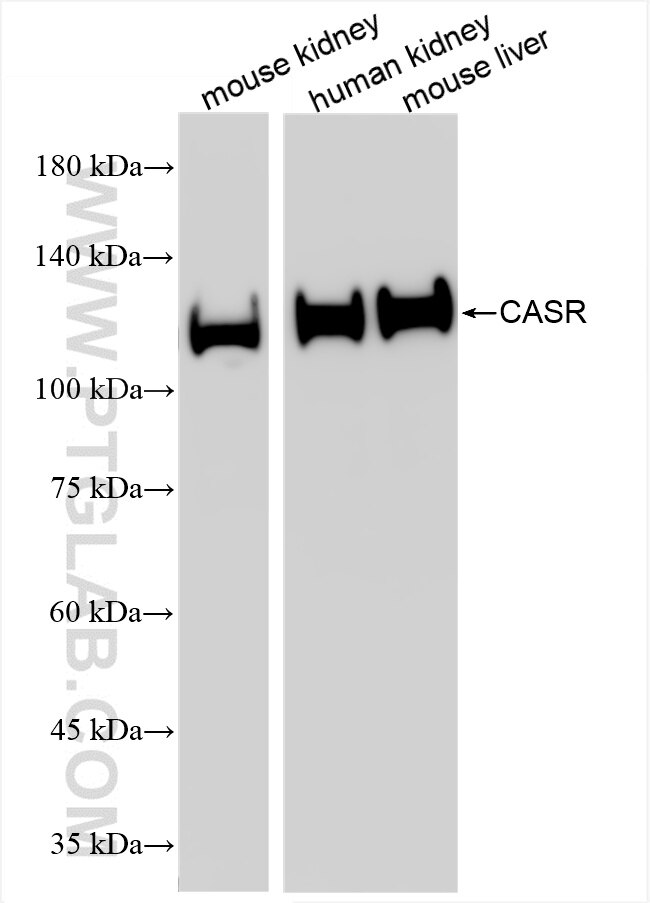 Western Blot (WB) analysis of various lysates using CASR Recombinant antibody (86319-1-RR)