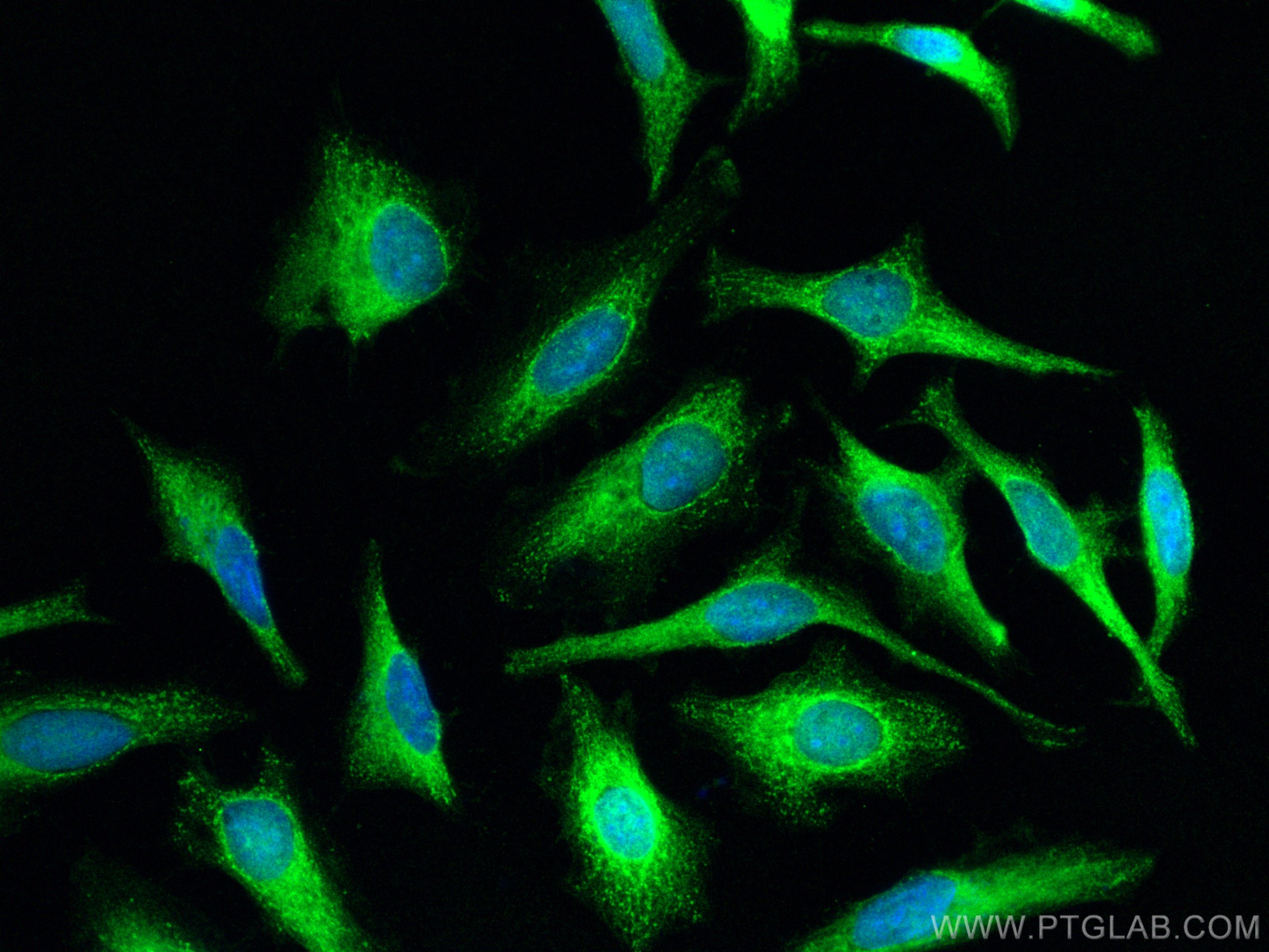 Immunofluorescence (IF) / fluorescent staining of HeLa cells using Calpastatin Polyclonal antibody (12250-1-AP)