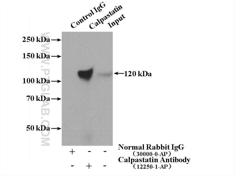 IP experiment of K-562 using 12250-1-AP