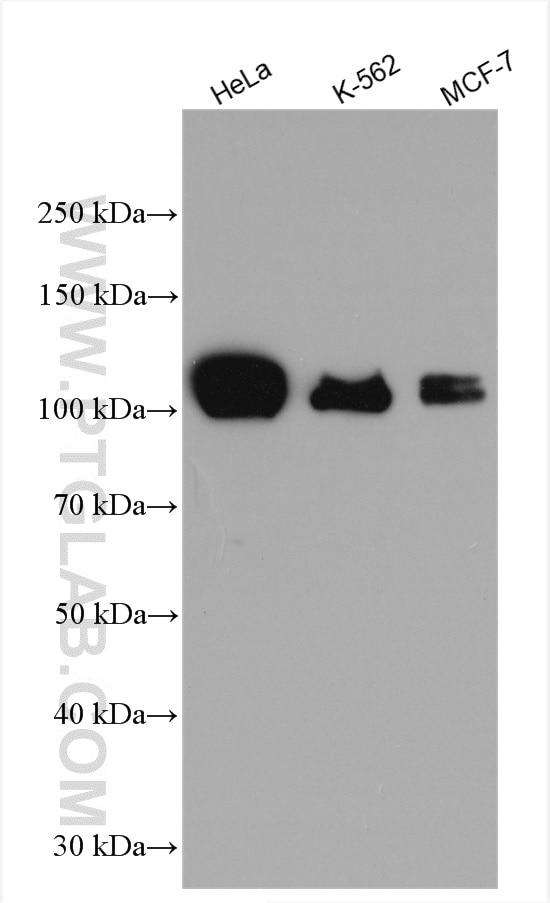 Western Blot (WB) analysis of various lysates using Calpastatin Polyclonal antibody (12250-1-AP)