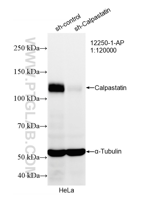 WB result of Calpastatin antibody (12250-1-AP; 1:120000; incubated at room temperature for 1.5 hours) with sh-Control and sh-Calpastatin transfected HeLa cells. Western Blot (WB) analysis of HeLa cells using Calpastatin Polyclonal antibody (12250-1-AP)