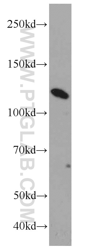 Western Blot (WB) analysis of K-562 cells using Calpastatin Polyclonal antibody (12250-1-AP)