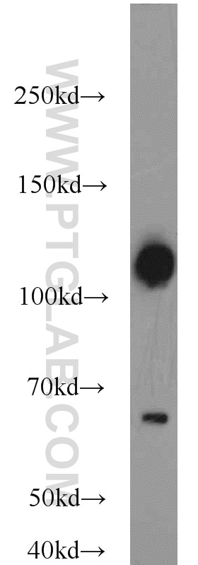 Western Blot (WB) analysis of MCF-7 cells using Calpastatin Polyclonal antibody (12250-1-AP)