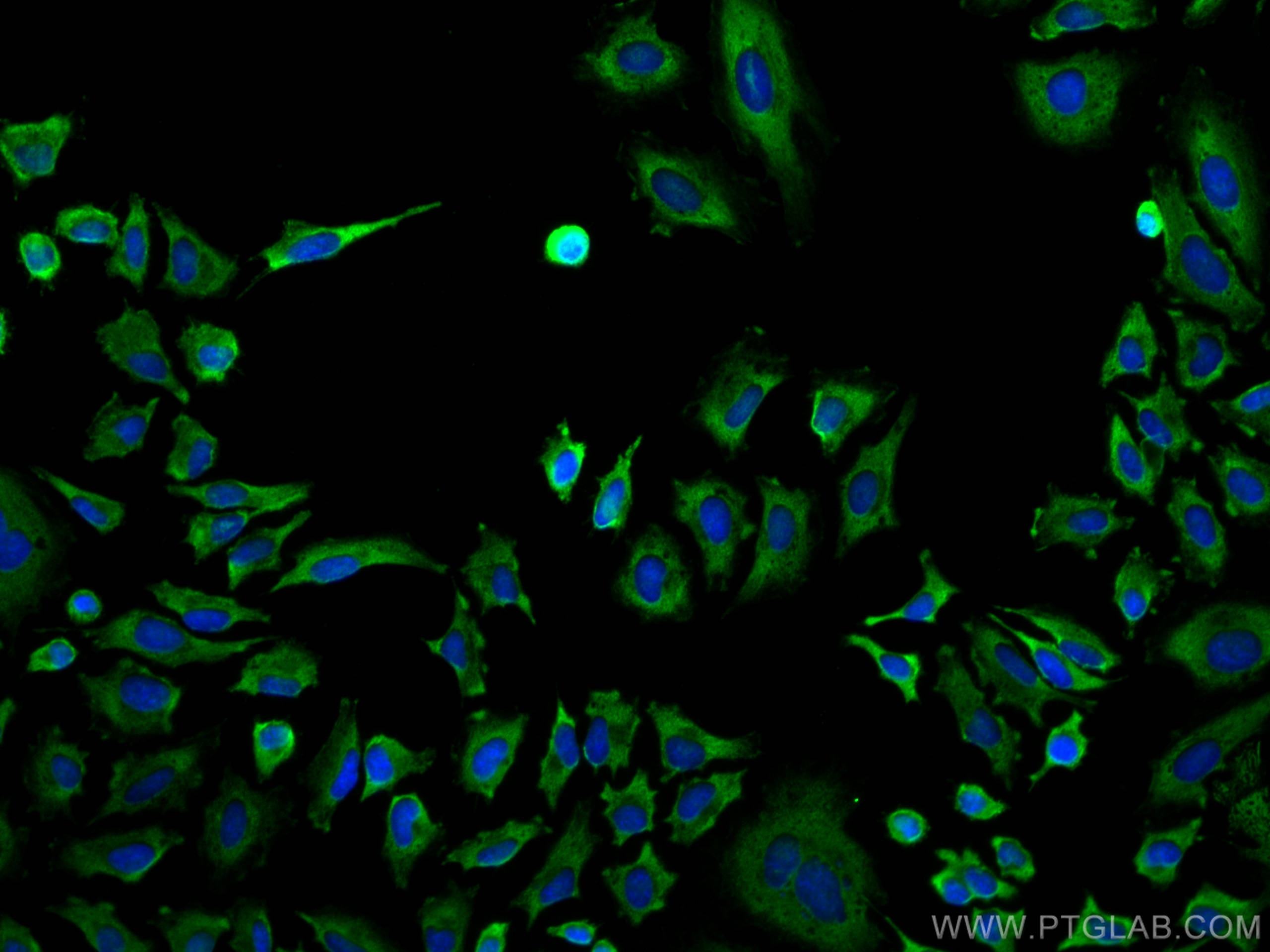 Immunofluorescence (IF) / fluorescent staining of HeLa cells using Calpastatin Monoclonal antibody (67107-1-Ig)