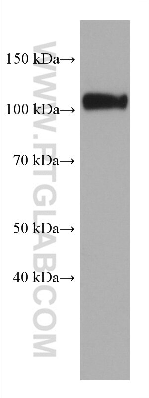 Western Blot (WB) analysis of LNCaP cells using Calpastatin Monoclonal antibody (67107-1-Ig)