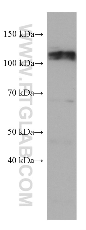 Western Blot (WB) analysis of MCF-7 cells using Calpastatin Monoclonal antibody (67107-1-Ig)