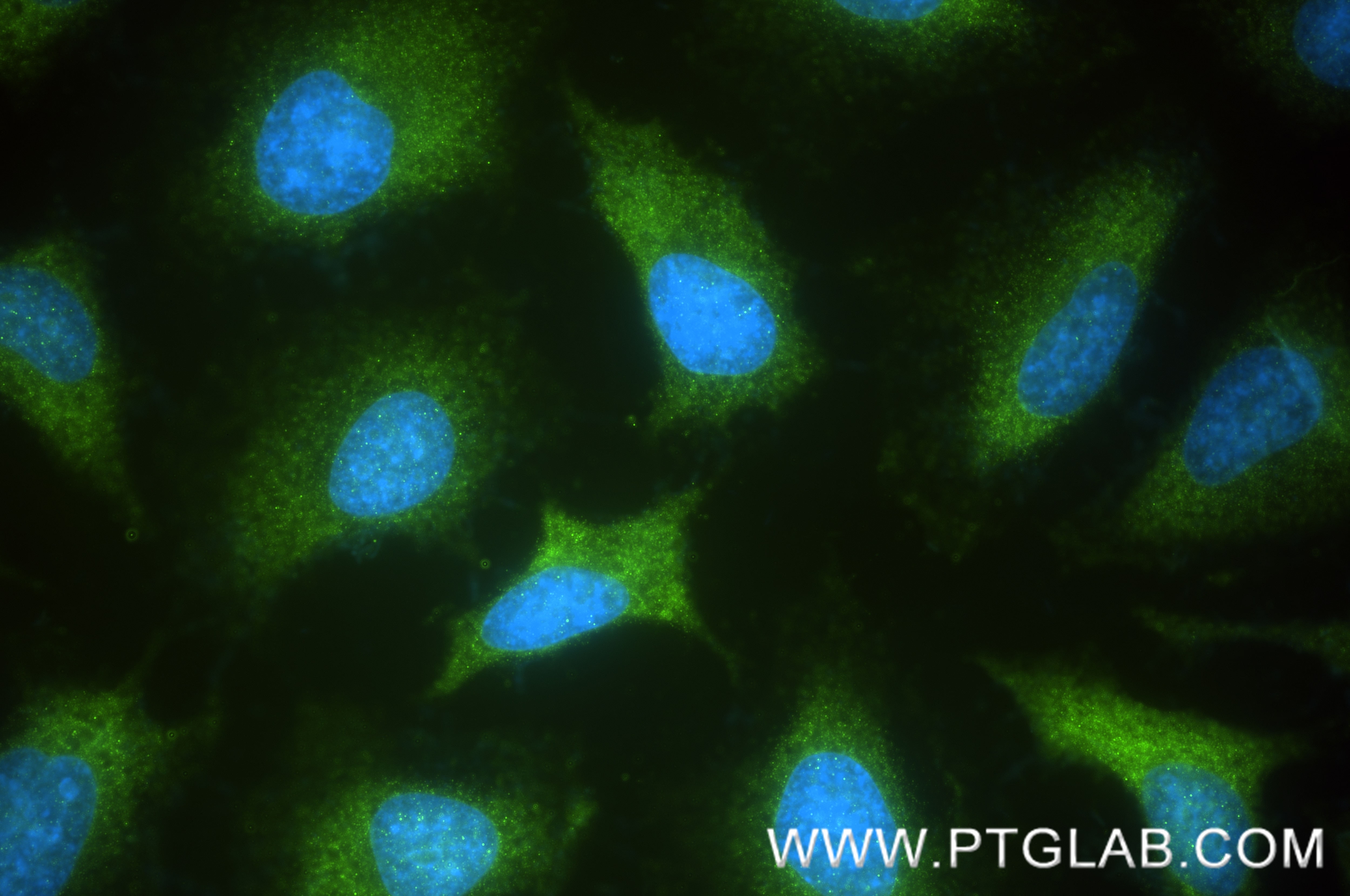 IF Staining of HeLa using 86664-3-RR (same clone as 86664-3-PBS) Immunofluorescence (IF) / fluorescent staining of HeLa cells using Calpastatin Recombinant monoclonal antibody (86664-3-RR)