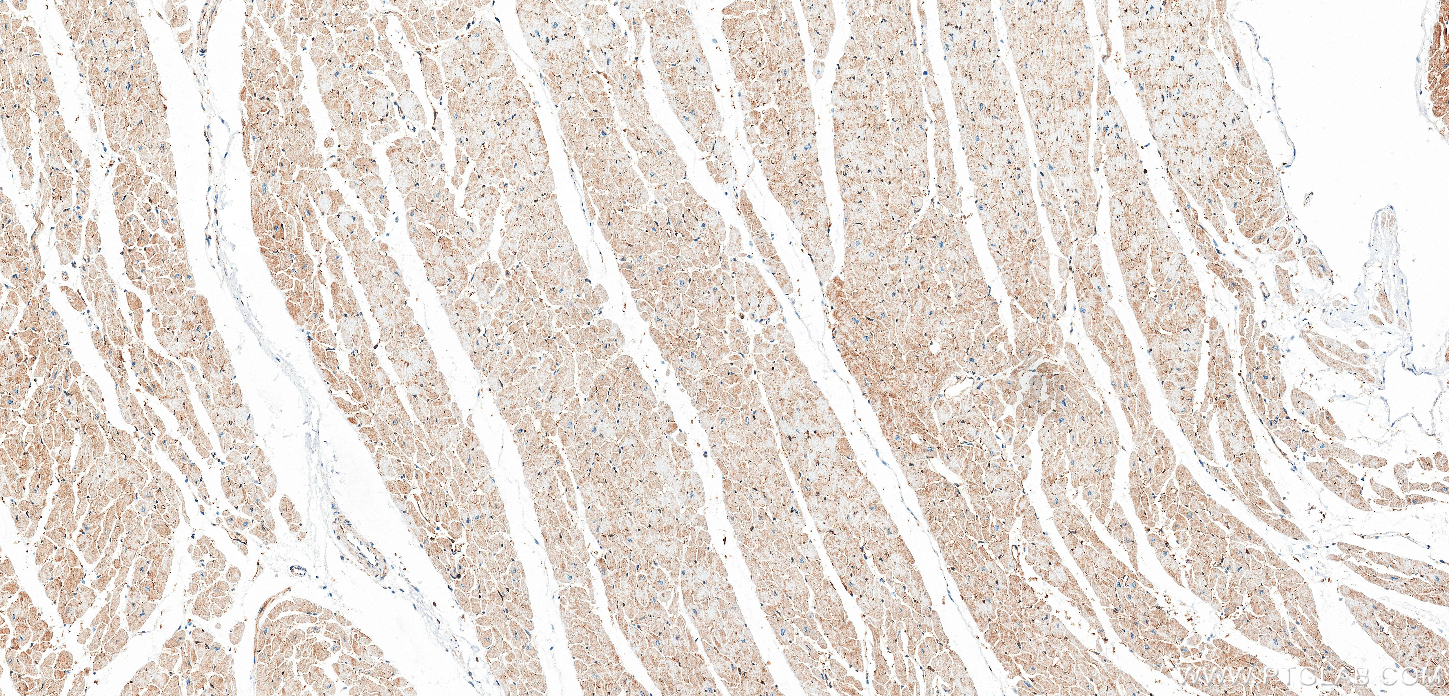 IHC staining of human heart using 86664-3-RR (same clone as 86664-3-PBS) Immunohistochemistry (IHC) staining of human heart tissue using Calpastatin Recombinant monoclonal antibody (86664-3-RR)