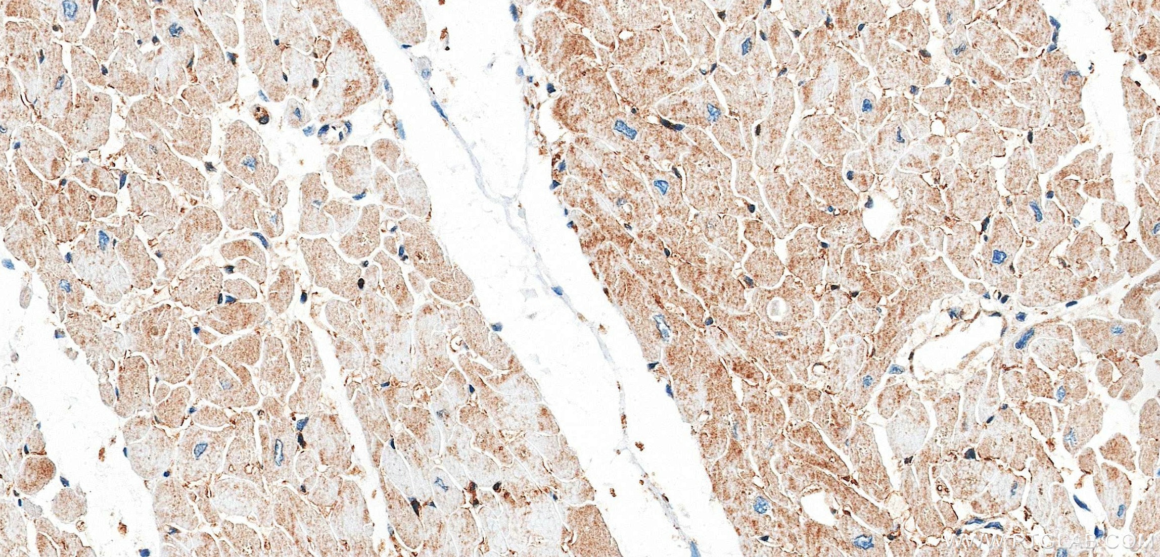 IHC staining of human heart using 86664-3-RR (same clone as 86664-3-PBS) Immunohistochemistry (IHC) staining of human heart tissue using Calpastatin Recombinant monoclonal antibody (86664-3-RR)