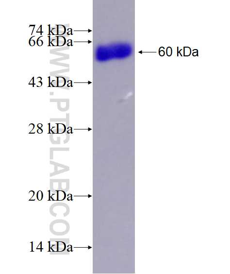 CAST fusion protein Ag28669 SDS-PAGE