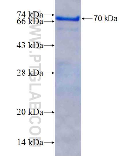 CAST fusion protein Ag2897 SDS-PAGE