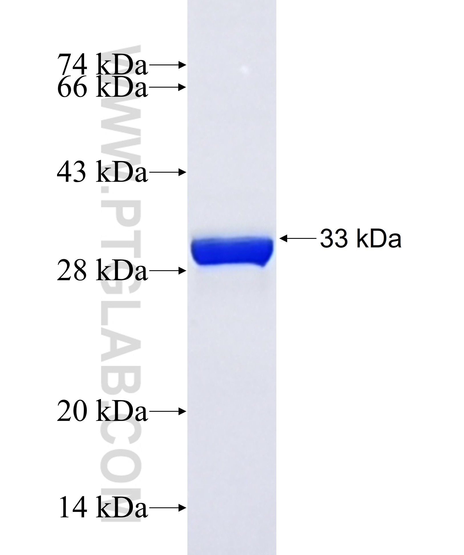 CASTOR1 fusion protein Ag43380 SDS-PAGE CASTOR1 fusion protein Ag43380 SDS-PAGE