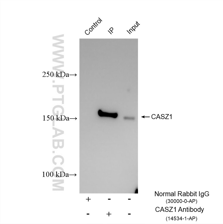 IP experiment of C2C12 using 14534-1-AP Immunoprecipitation (IP) experiment of C2C12 cells using CASZ1 Polyclonal antibody (14534-1-AP)