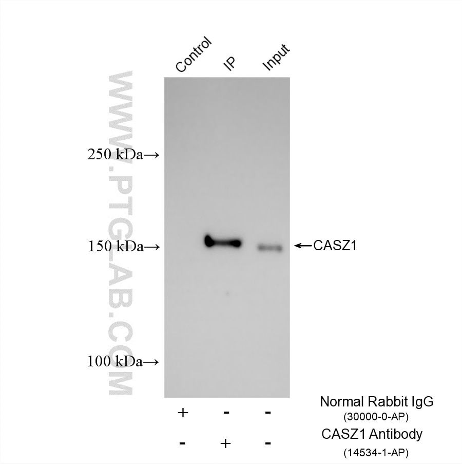 IP experiment of HUVEC using 14534-1-AP Immunoprecipitation (IP) experiment of HUVEC cells using CASZ1 Polyclonal antibody (14534-1-AP)