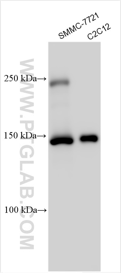 Western Blot (WB) analysis of various lysates using CASZ1 Polyclonal antibody (14534-1-AP)