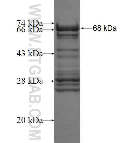CASZ1 fusion protein Ag6035 SDS-PAGE