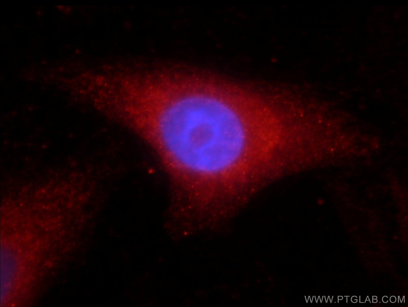 Immunofluorescence (IF) / fluorescent staining of HepG2 cells using Catalase Polyclonal antibody (21260-1-AP)