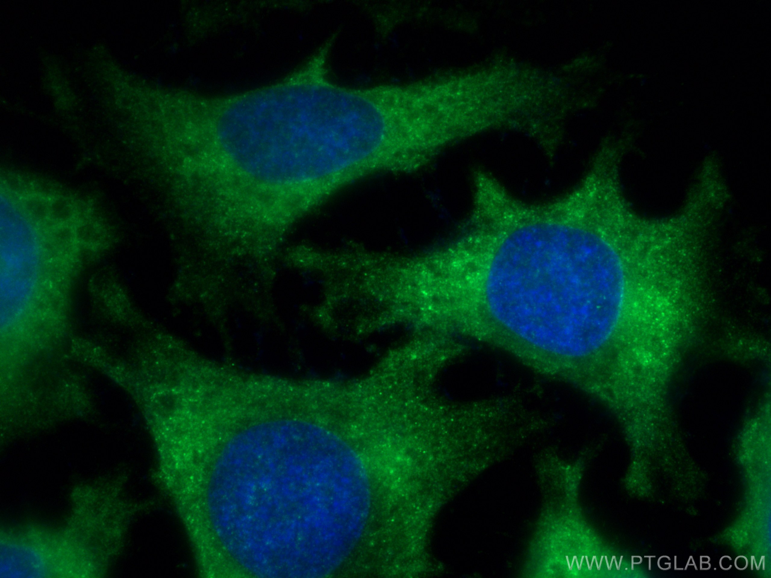 Immunofluorescence (IF) / fluorescent staining of HeLa cells using Catalase Polyclonal antibody (21260-1-AP)