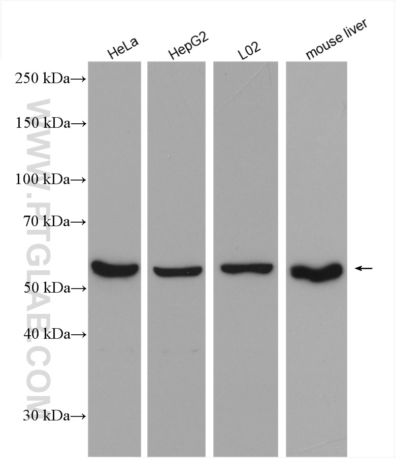 Western Blot (WB) analysis of various lysates using Catalase Polyclonal antibody (21260-1-AP)