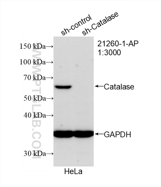 Western Blot (WB) analysis of HeLa cells using Catalase Polyclonal antibody (21260-1-AP)