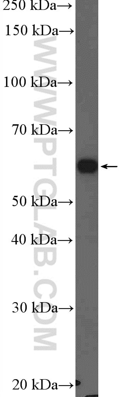 Western Blot (WB) analysis of Jurkat cells using Catalase Polyclonal antibody (21260-1-AP)