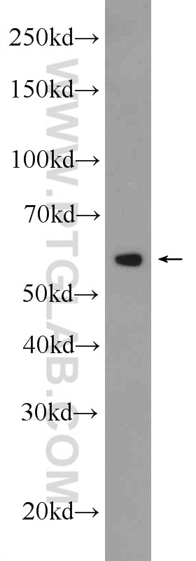 Western Blot (WB) analysis of Raji cells using Catalase Polyclonal antibody (21260-1-AP)
