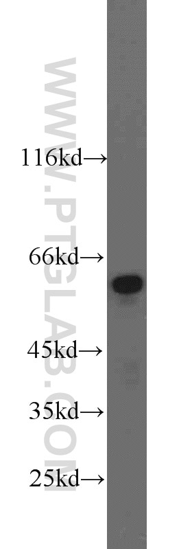 Western Blot (WB) analysis of rat liver tissue using Catalase Polyclonal antibody (21260-1-AP)